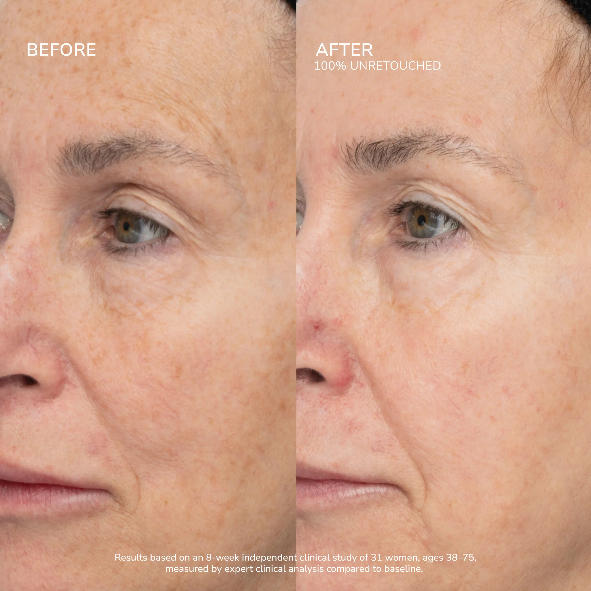 SeneCell™ SenePlex+® StemCell Concentrate - Image 6