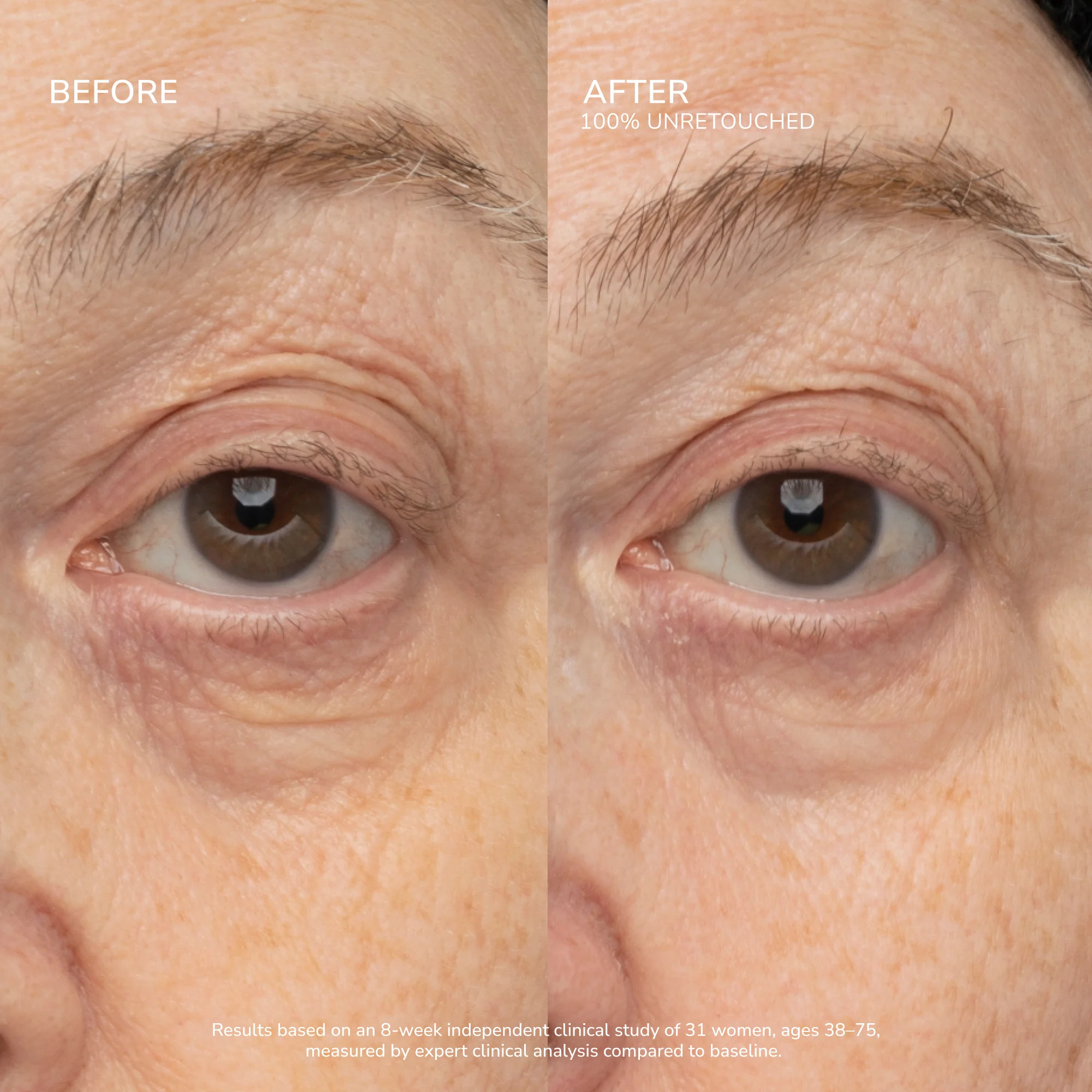 SeneCell™ SenePlex+® StemCell Concentrate - Image 8