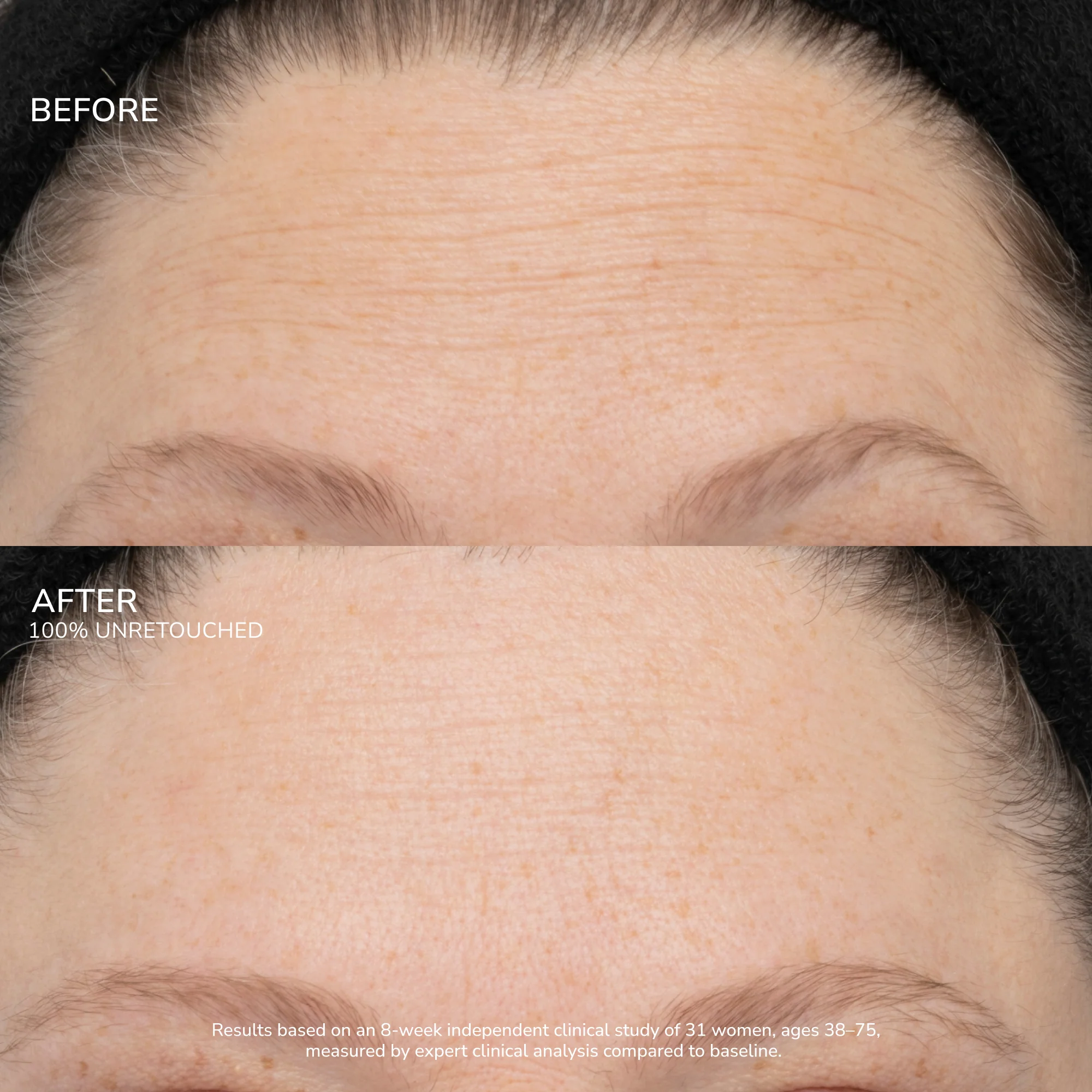 SeneCell™ SenePlex+® StemCell Concentrate - Image 9